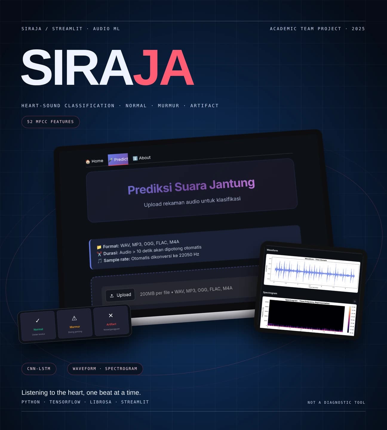 SIRAJA cover: heart-sound prediction page in a laptop mockup, with a tablet showing waveform and spectrogram and a card of the Normal, Murmur and Artifact classes, on a dark blue background.